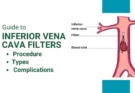 Essential Guide to Inferior Vena Cava Filters: Procedure, Types, and Complications