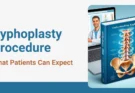 Kyphoplasty Procedure: What Patients Can Expect