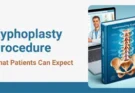 Kyphoplasty Procedure feature image