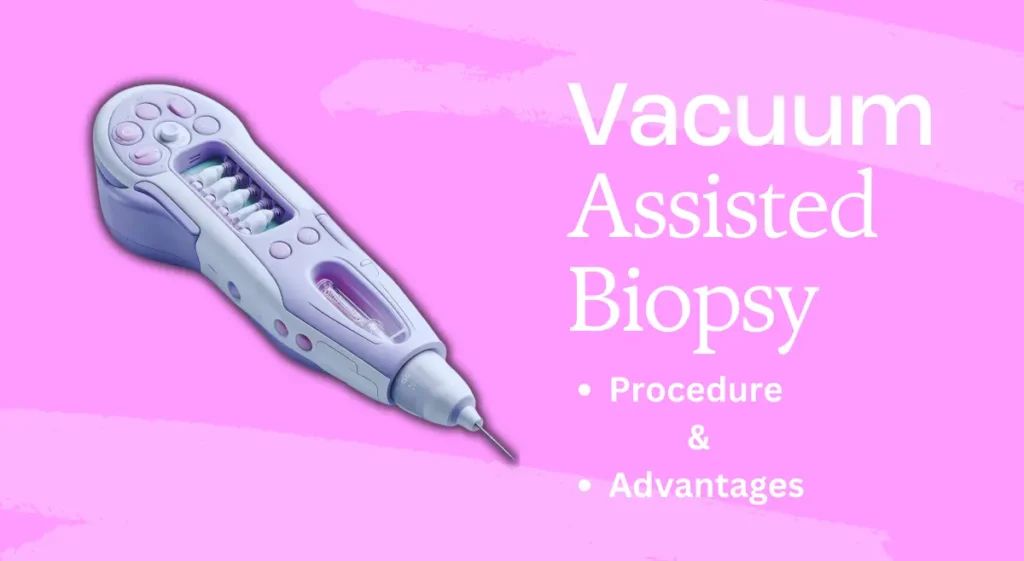 Understanding Vacuum-Assisted Biopsy