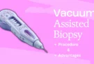 Understanding Vacuum-Assisted Biopsy: Procedure and Advantages
