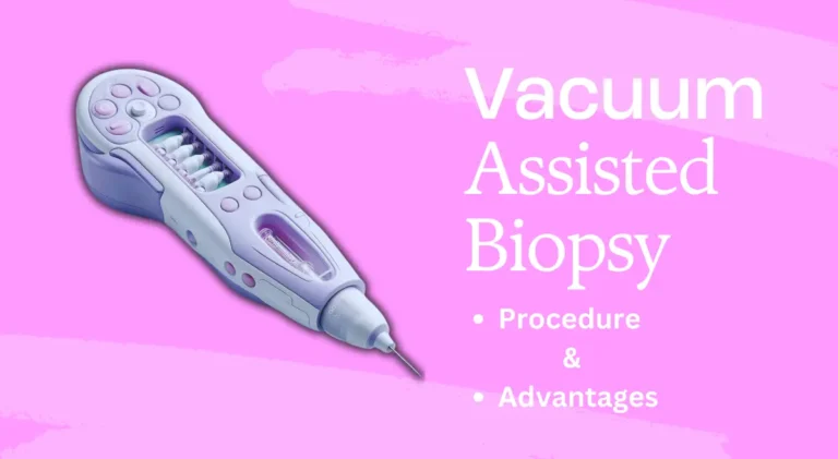 Understanding Vacuum-Assisted Biopsy