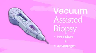 Understanding Vacuum-Assisted Biopsy featured image