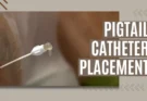 Pigtail Catheter Placement: A Comprehensive Guide