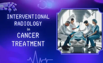 Interventional Radiology in Cancer Treatment