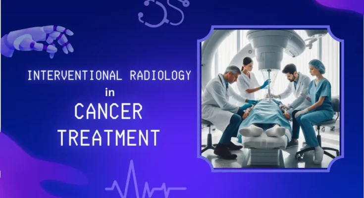 Interventional Radiology in Cancer Treatment