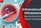 Intravascular Ultrasound