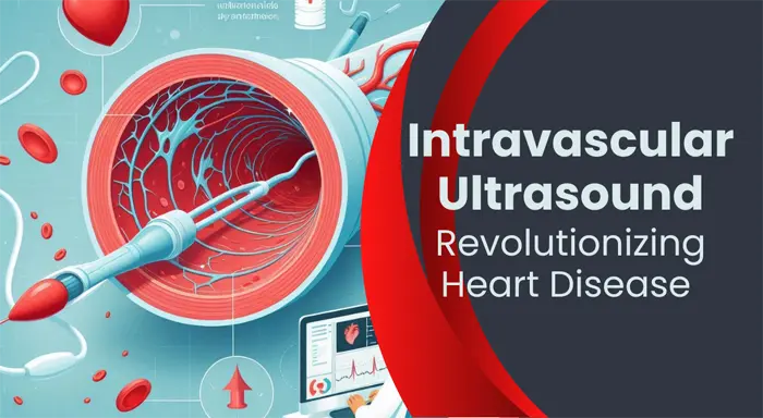 Intravascular Ultrasound